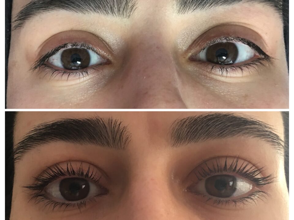 Kirpik Lifting Uygulamamız