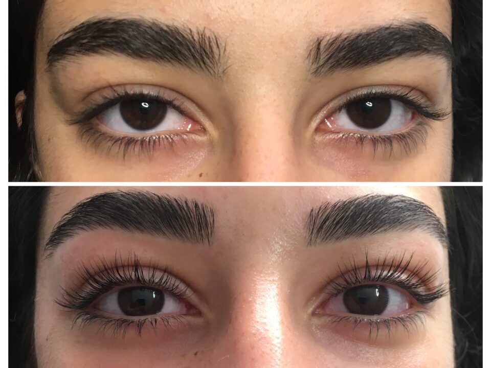 Kirpik Lifting Uygulaması